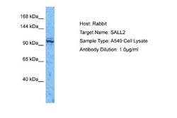 SALL2 Antibody, Novus Biologicals 100 &mu;L; Unconjugated:Antibodies, Polyclonal